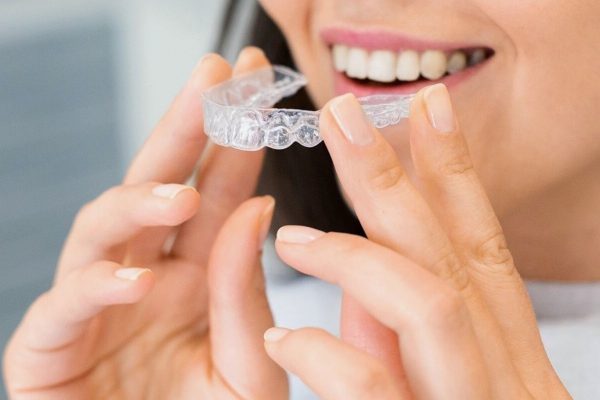 Invisalign avis : prix, contraintes et résultats à attendre
