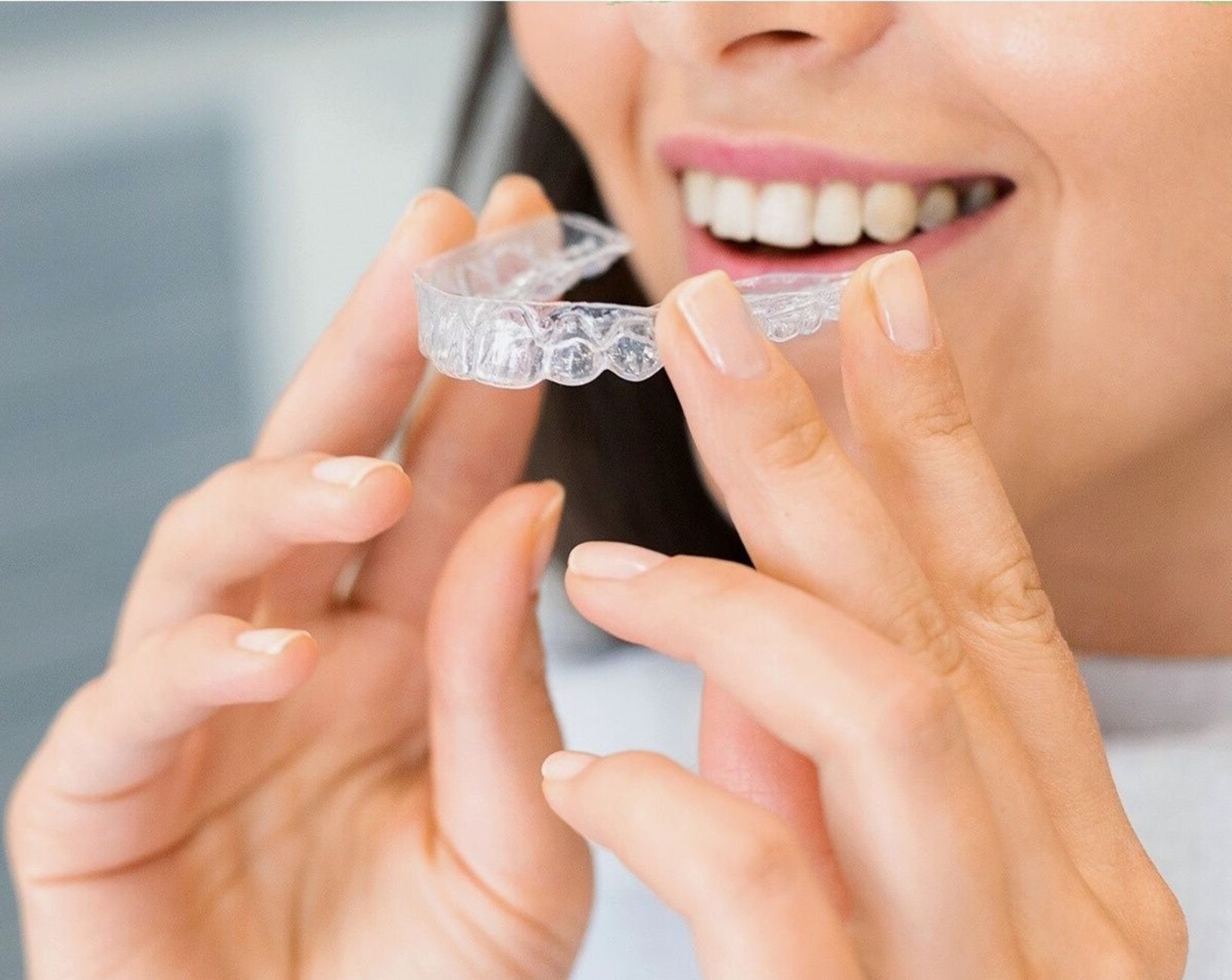 Invisalign avis : prix, contraintes et résultats à attendre
